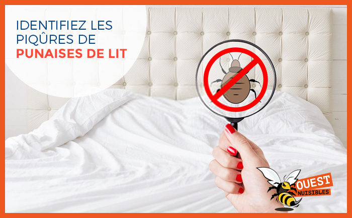 Détecter les piqures des punaises de lit